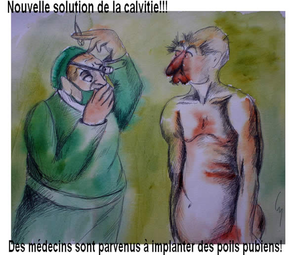 CB dessin Calvitie